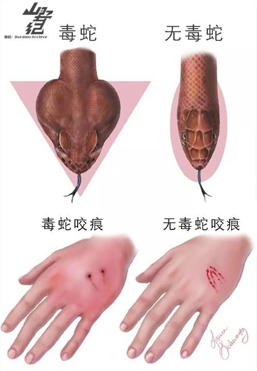 澳门今晚开什么号和每年超25万人被蛇咬与每年超25万人被蛇咬死